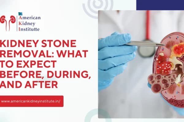Kidney Stone Removal: What to Expect Before, During, and After